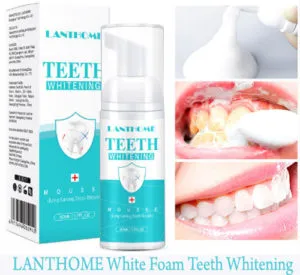 28140 teeth whitening before after