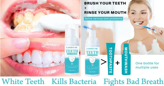 28140 teeth whitening methods