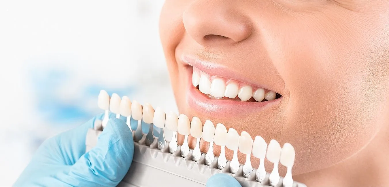 28144 teeth whitening near me cost