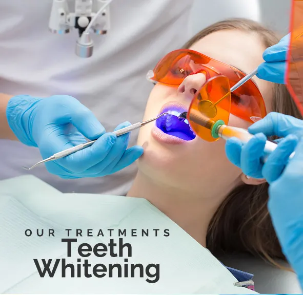 28144 teeth whitening near me in office