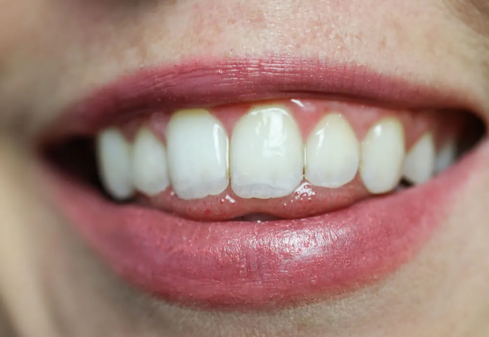 28145 dental health tips