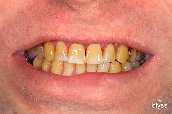 28151 pre authorization request