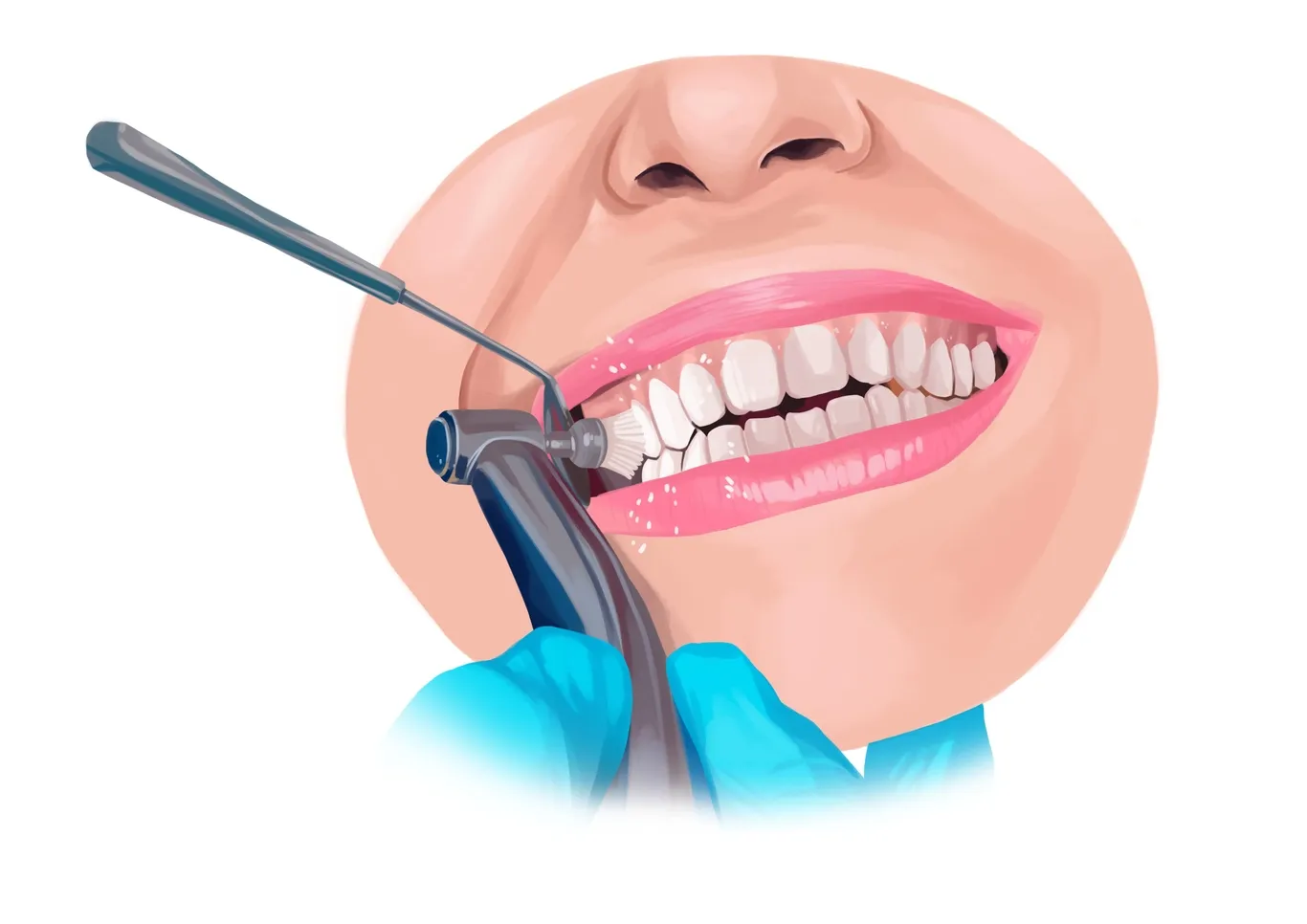 28151 teeth whitening procedures