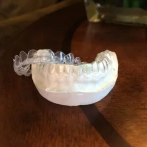 28155 teeth whitening consultation