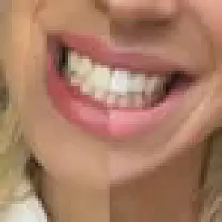/img/28157-smile-with-white-teeth.webp