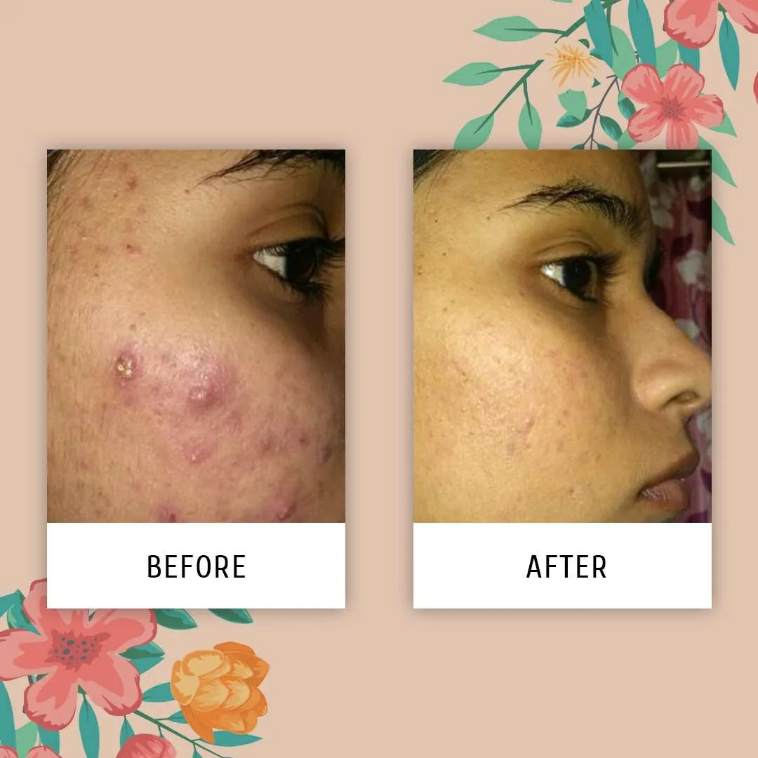 28158 even skin tone tips