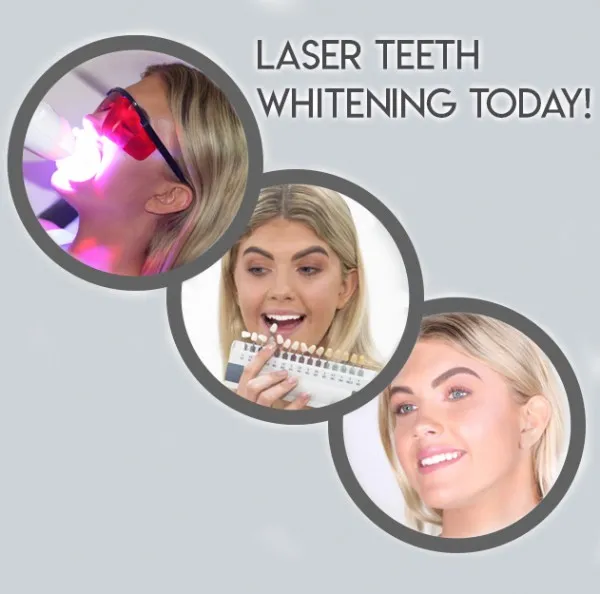 28159 professional teeth whitening