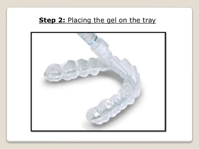 28162 bright smile maintenance