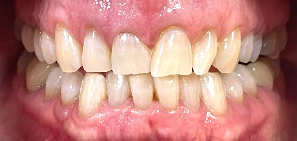 28169 pain management zoom whitening