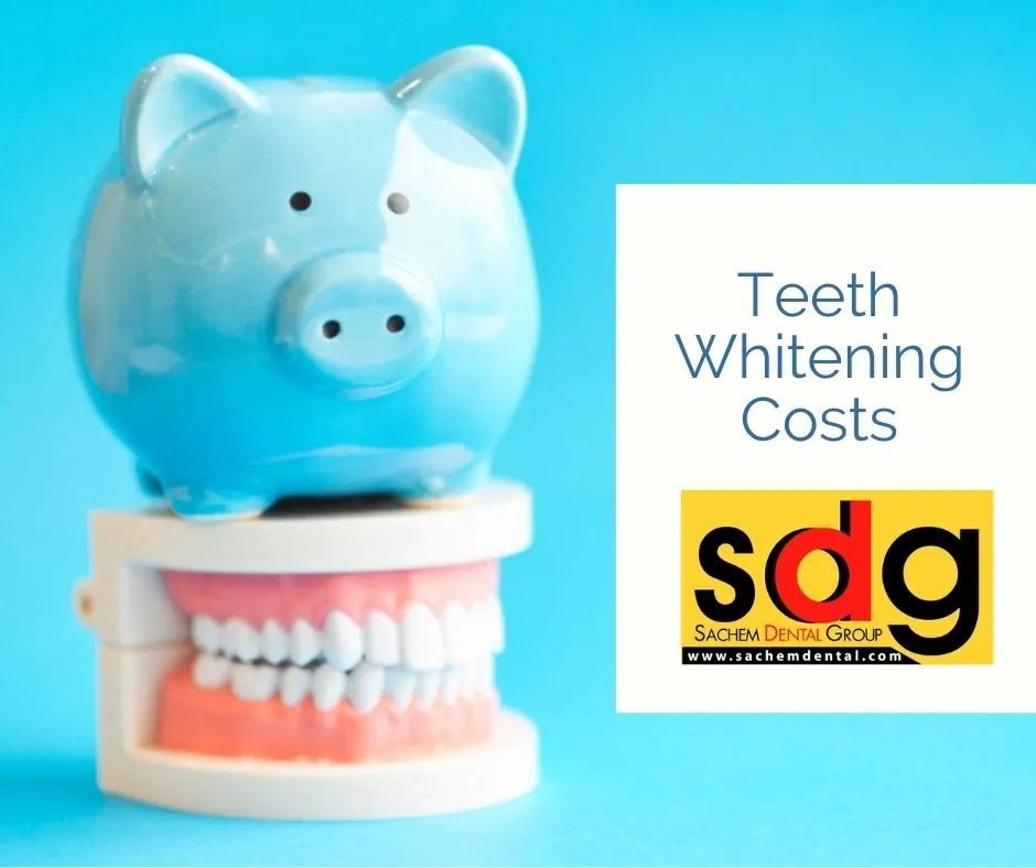 28170 icon teeth whitening cost overview