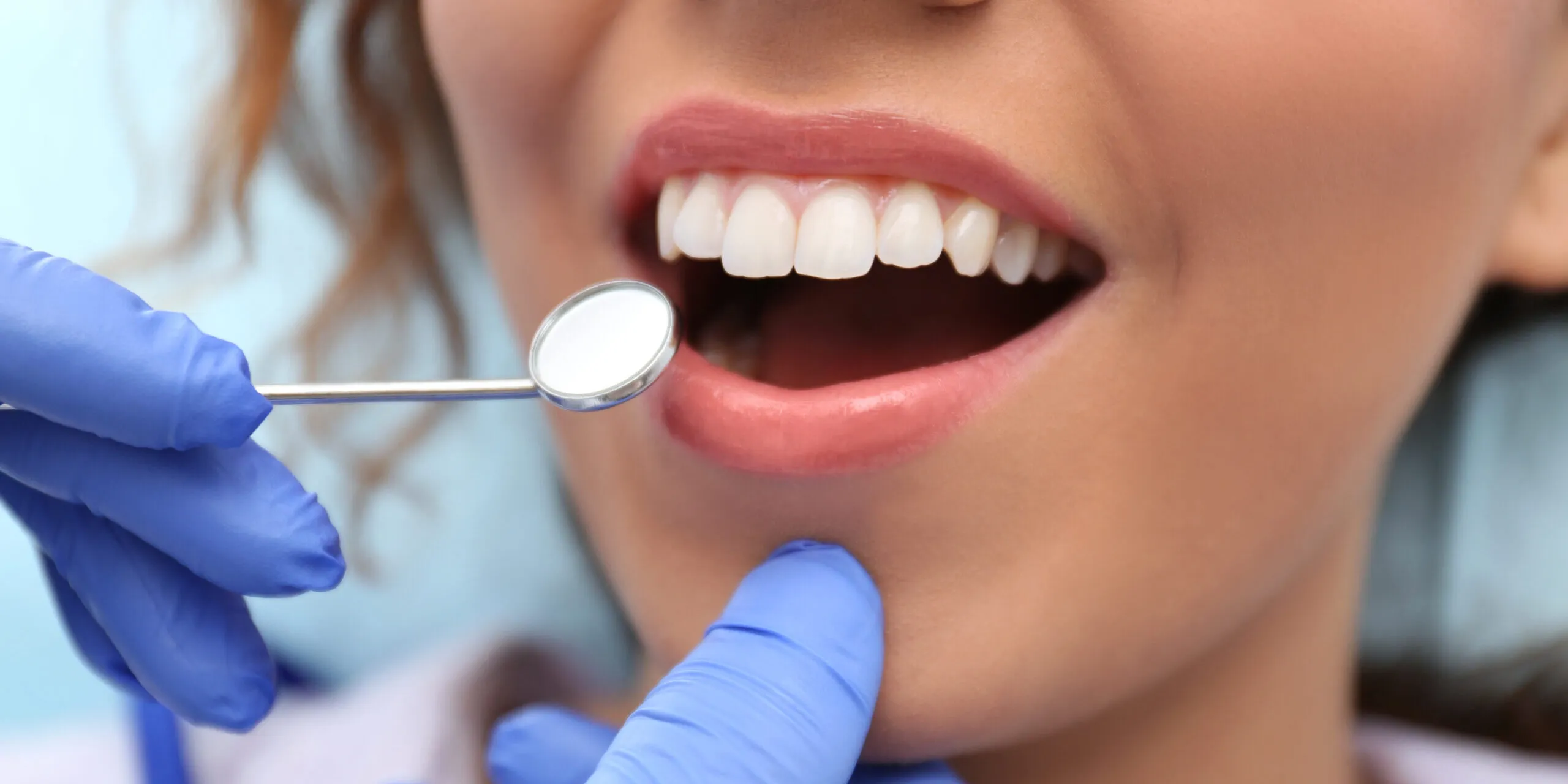 28172 activated charcoal teeth whitening