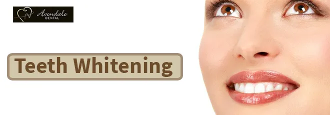 28175 teeth whitening options