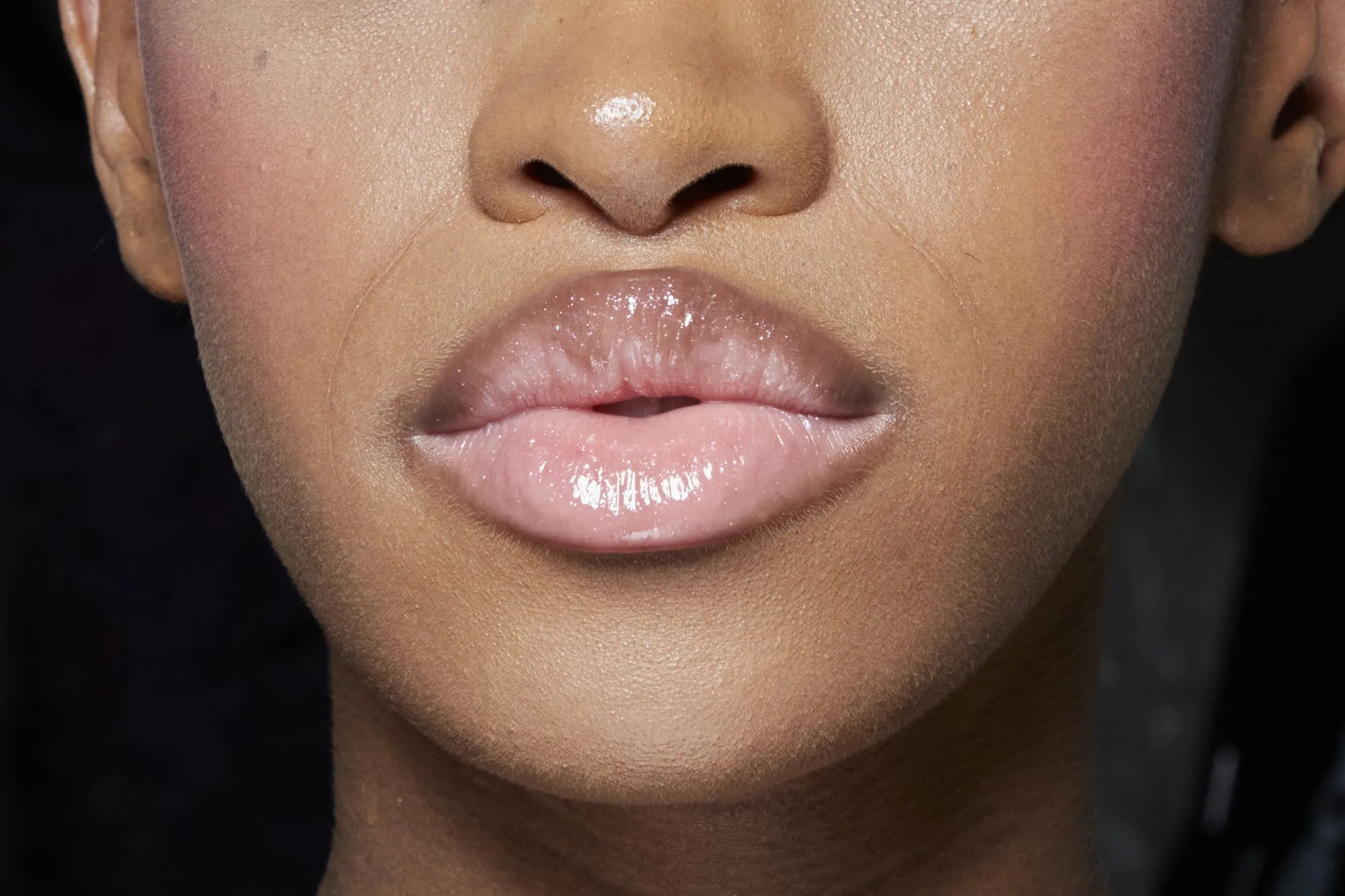 28187 professional lip treatments