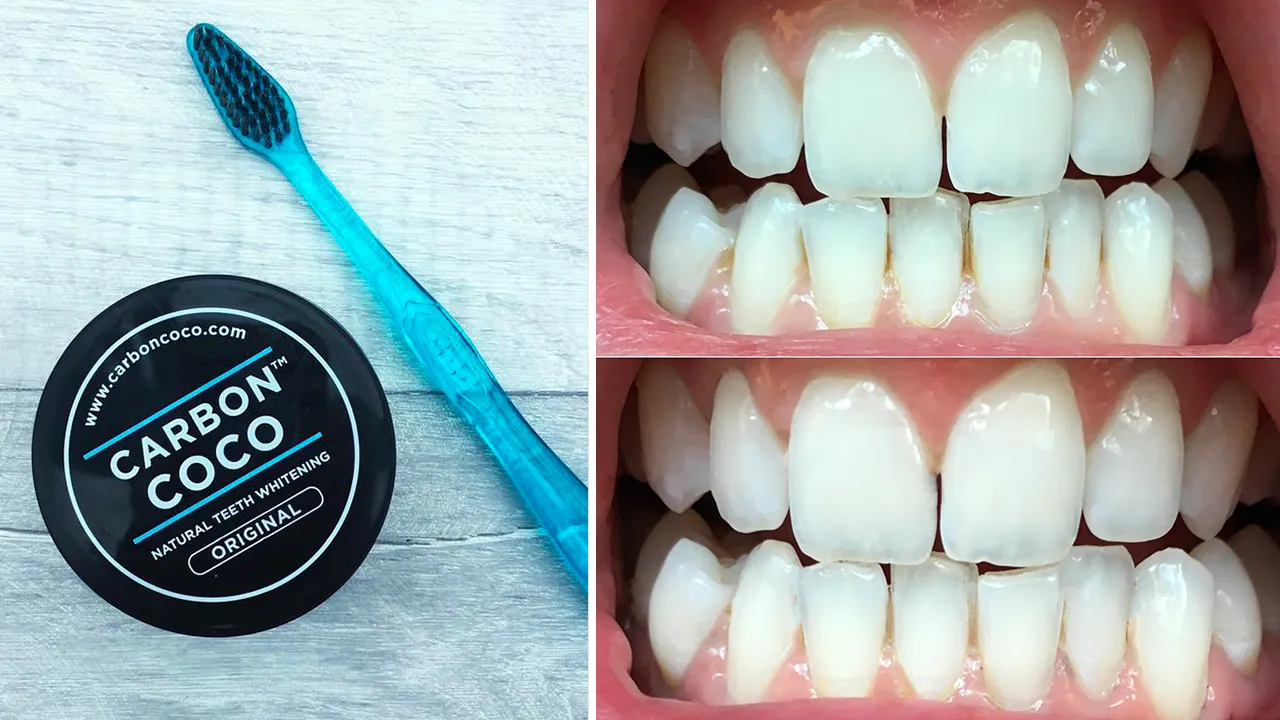 28198 teeth whitening convenience