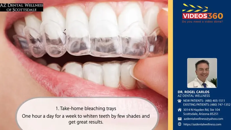 28202 scottsdale teeth whitening 4