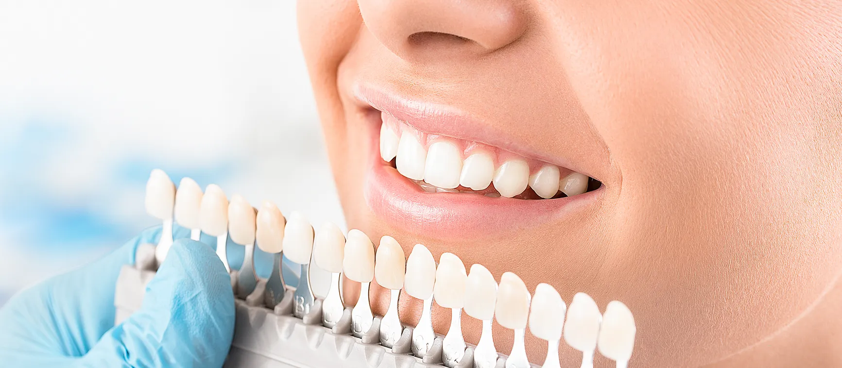 /img/28202-scottsdale-teeth-whitening-7.webp