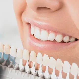 /img/28202-scottsdale-teeth-whitening-7.webp