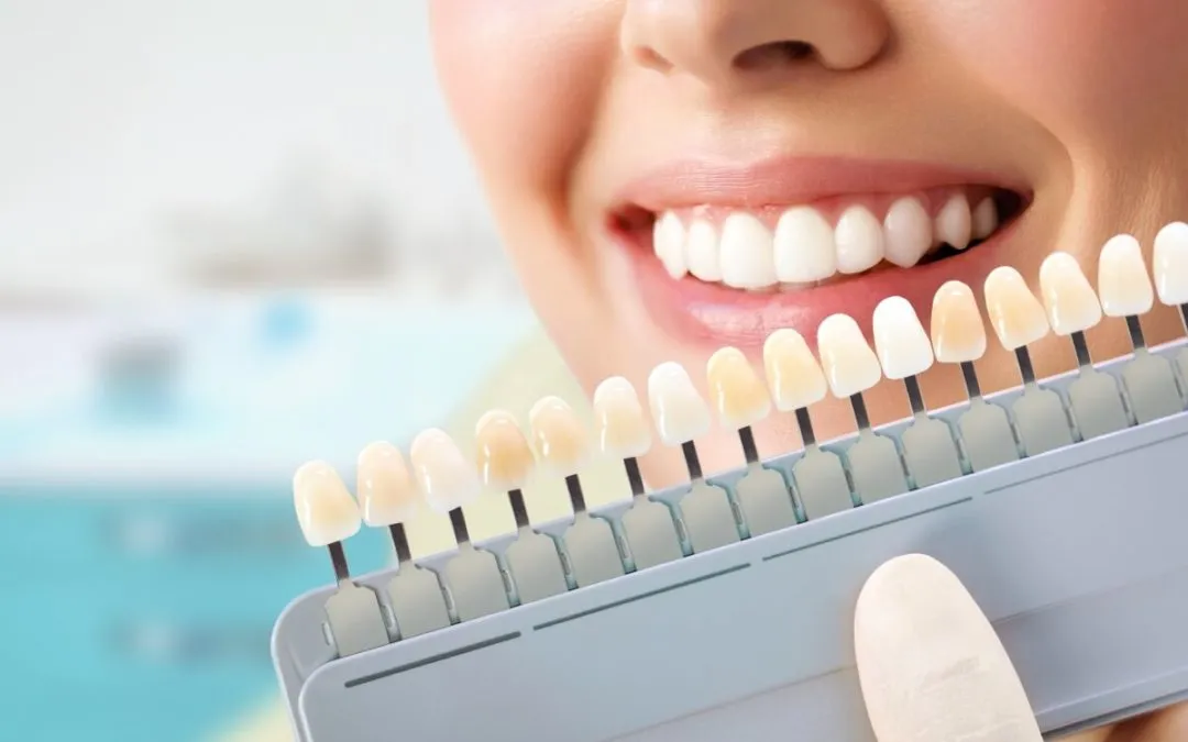 28204 teeth whitening smile