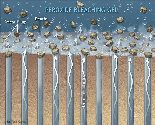 28205 peroxyl whitening benefits