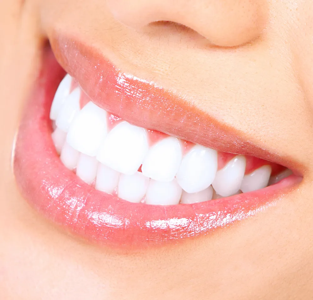 28208 confident smile teeth whitening