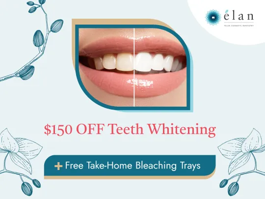 /img/28208-teeth-whitening-professional-success.webp