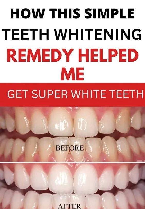 28210 baking soda whitening