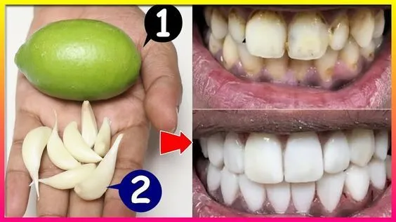 28210 healthy foods for teeth