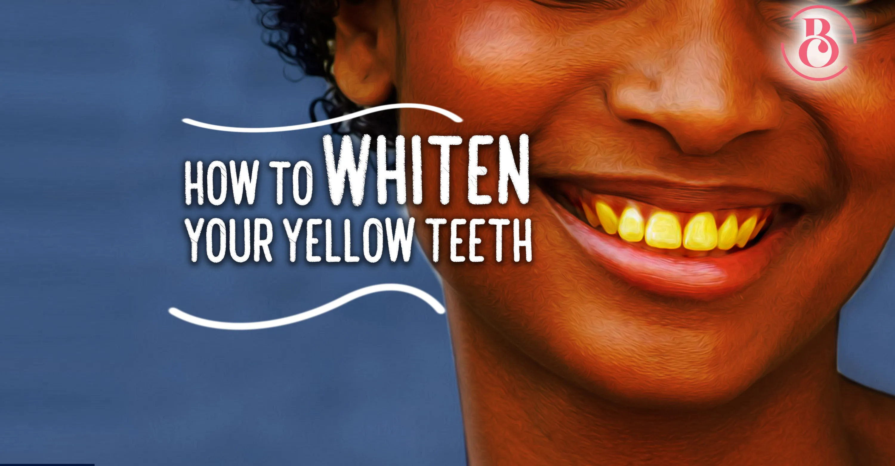 28210 yellow teeth causes