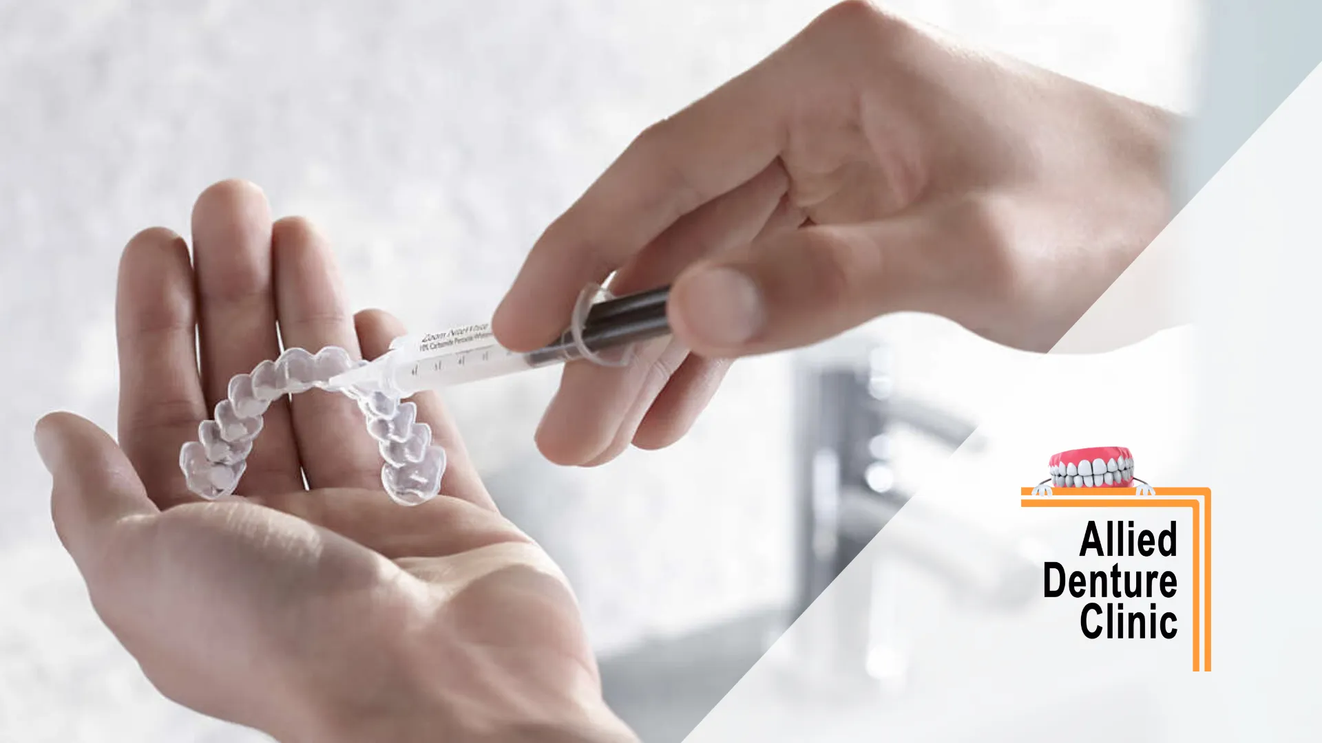 28212 teeth whitening fairbanks ak 6