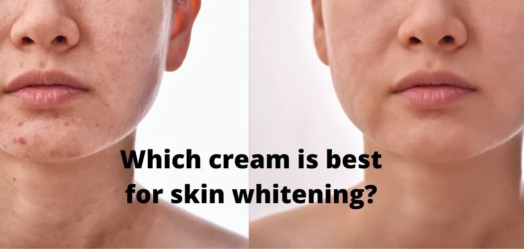 28224 skin types for cream
