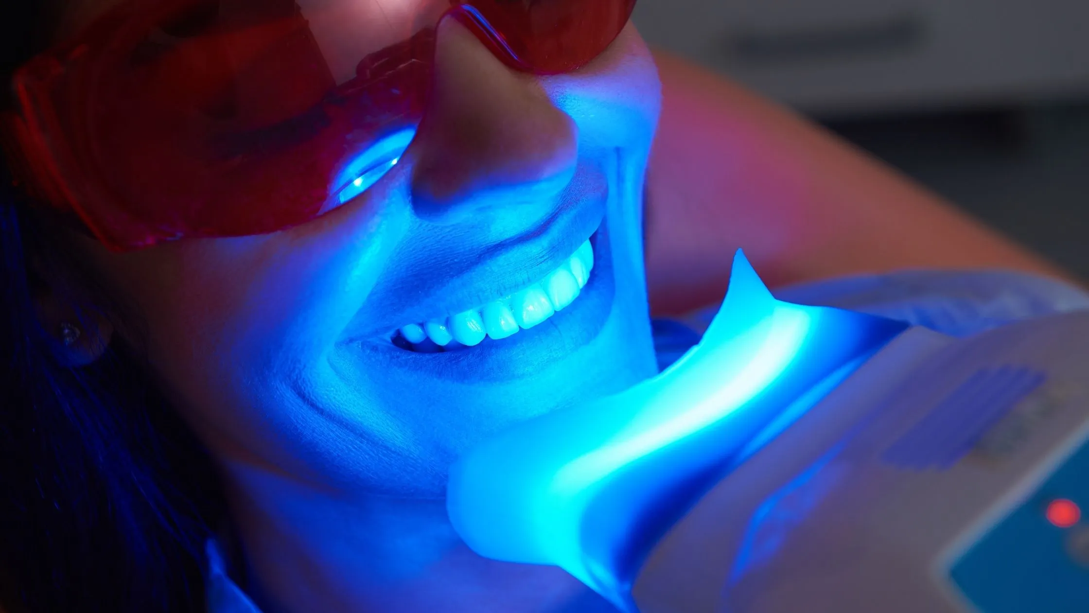 28226 zoom teeth whitening image3
