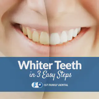 /img/28226-zoom-teeth-whitening-image7.webp
