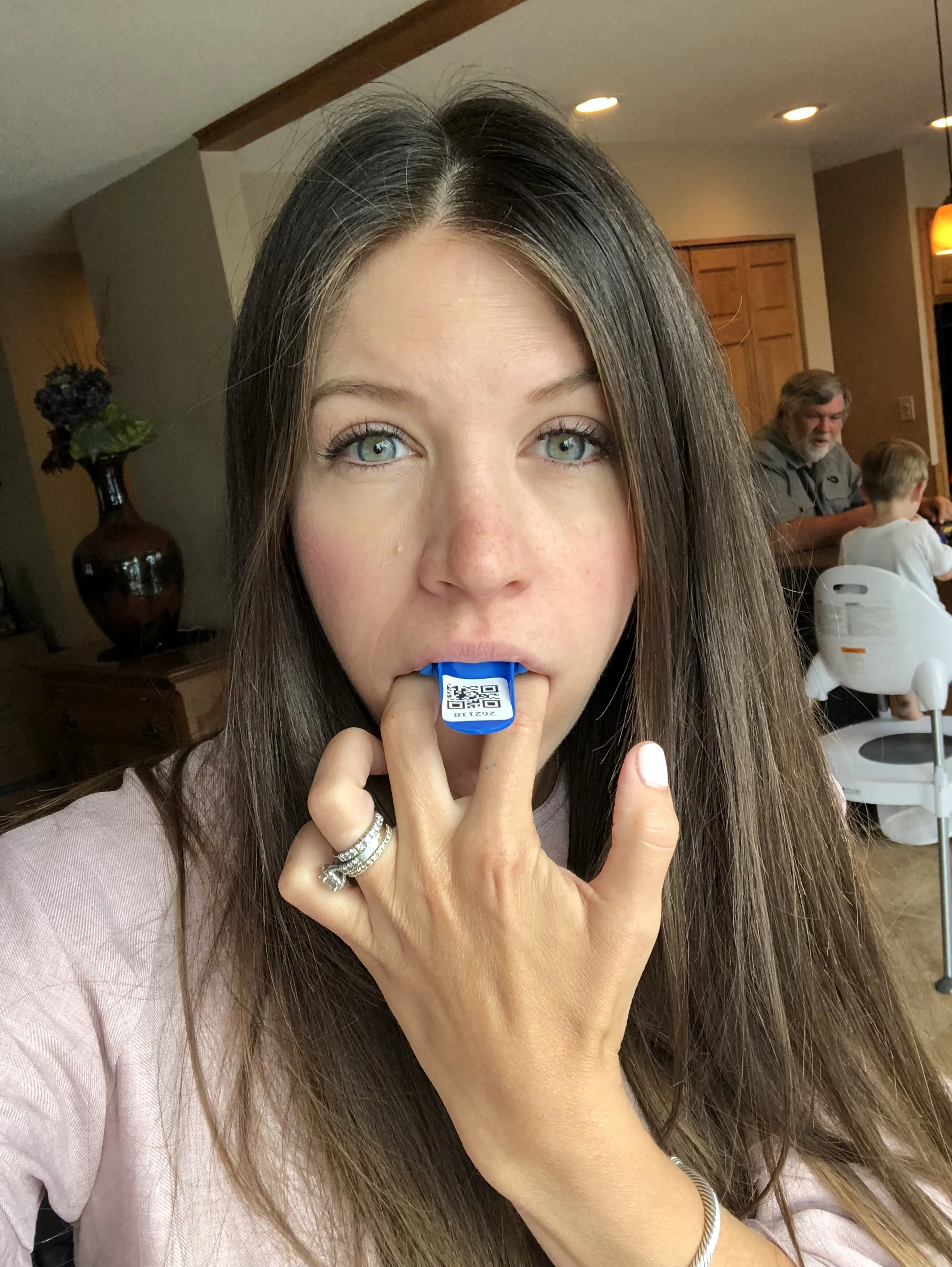 28228 sensitive teeth whitening 4