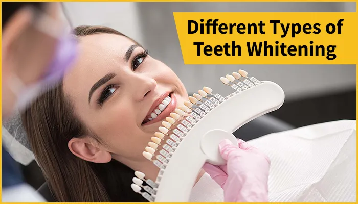 28231 teeth whitening toothpaste