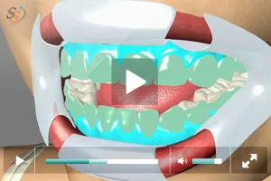 28238 whitening toothpaste