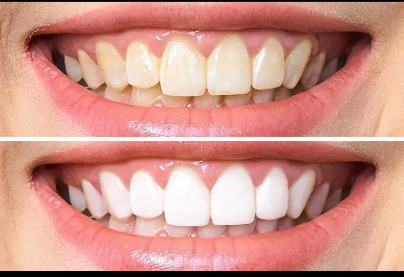 28245 staining foods drinks