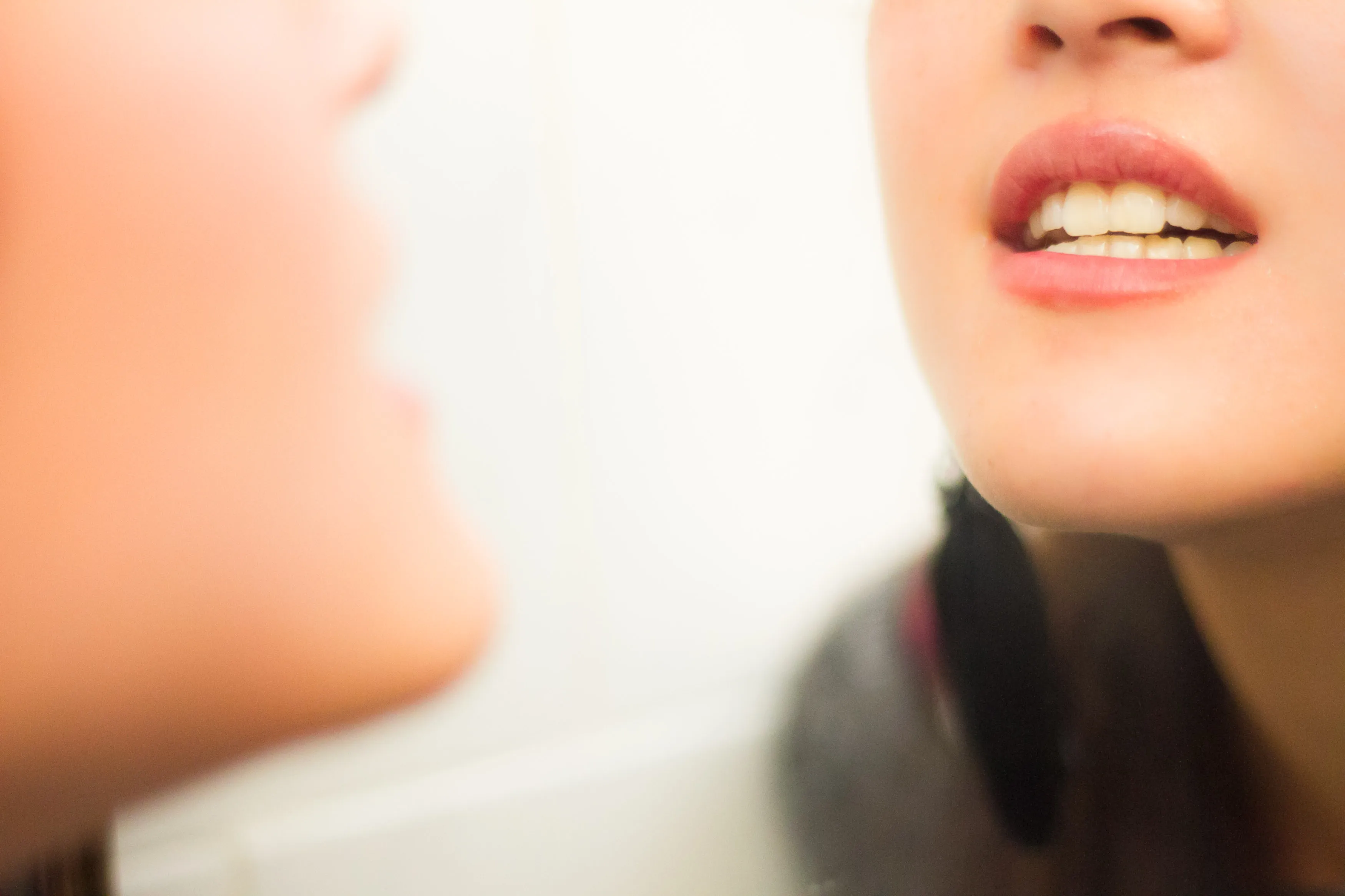 28247 teeth whitening results