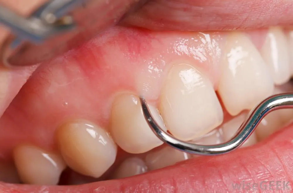 28249 sensitive gums