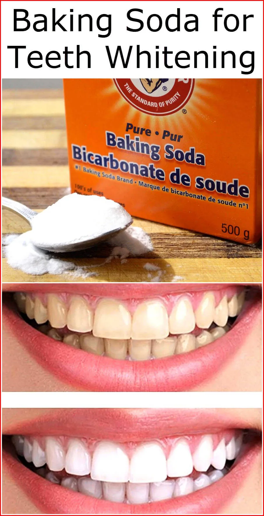 28250 baking soda teeth whitening before after