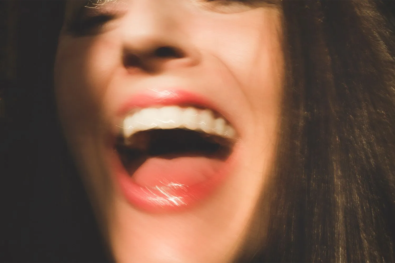 28253 professional teeth whitening