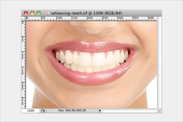 28257 photo editor teeth whitening 5