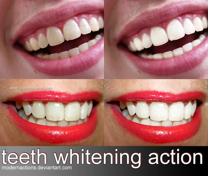 28257 photo editor teeth whitening 6