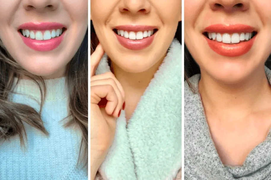 28260 avoiding staining foods