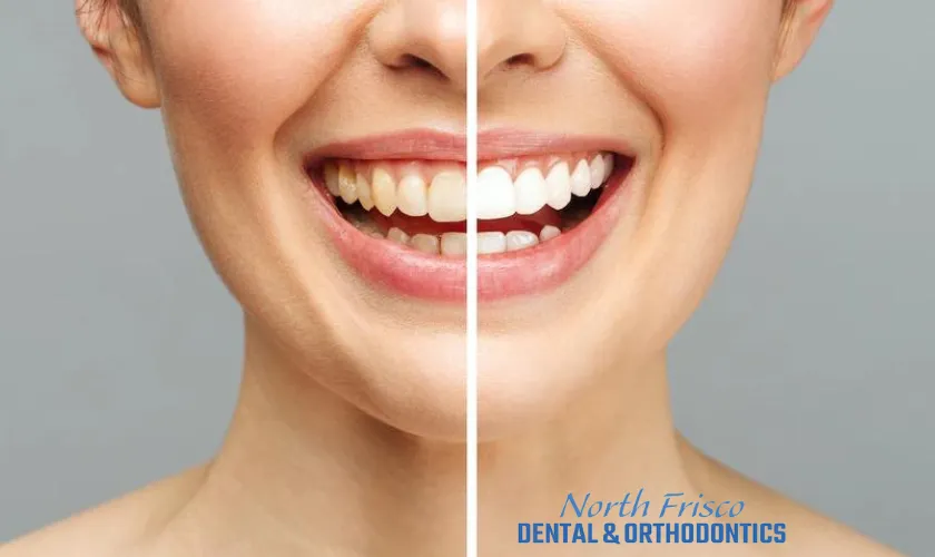 28264 teeth whitening consultation