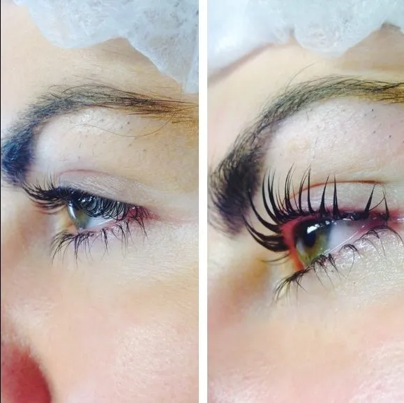 28278 teeth whitening aftercare