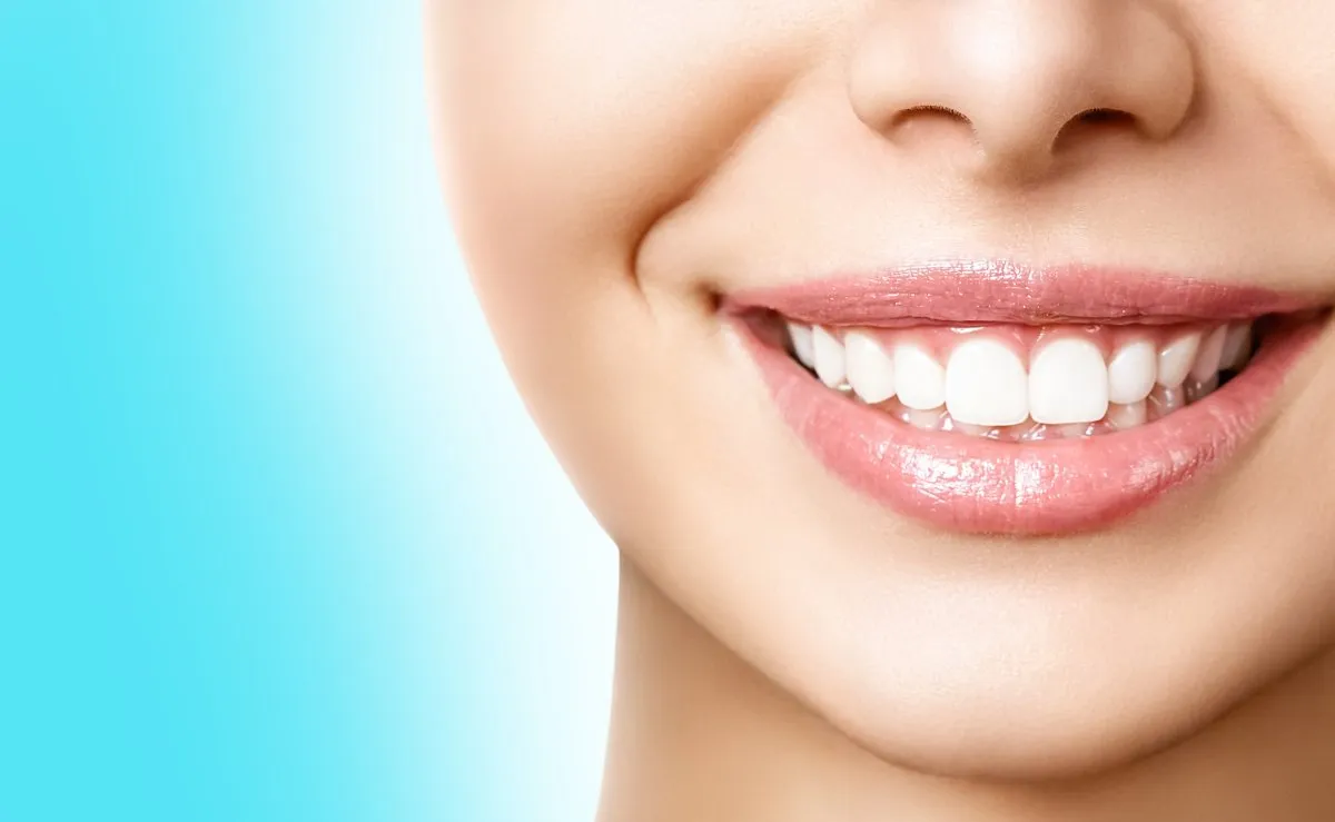 28278 teeth whitening procedure