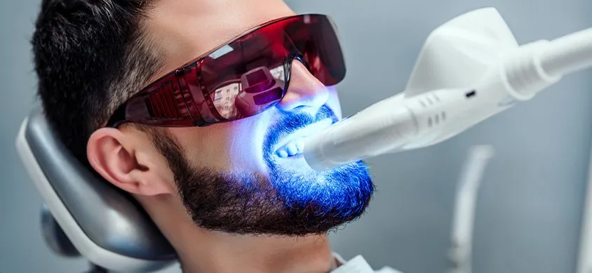 28279 davinci teeth whitening overview