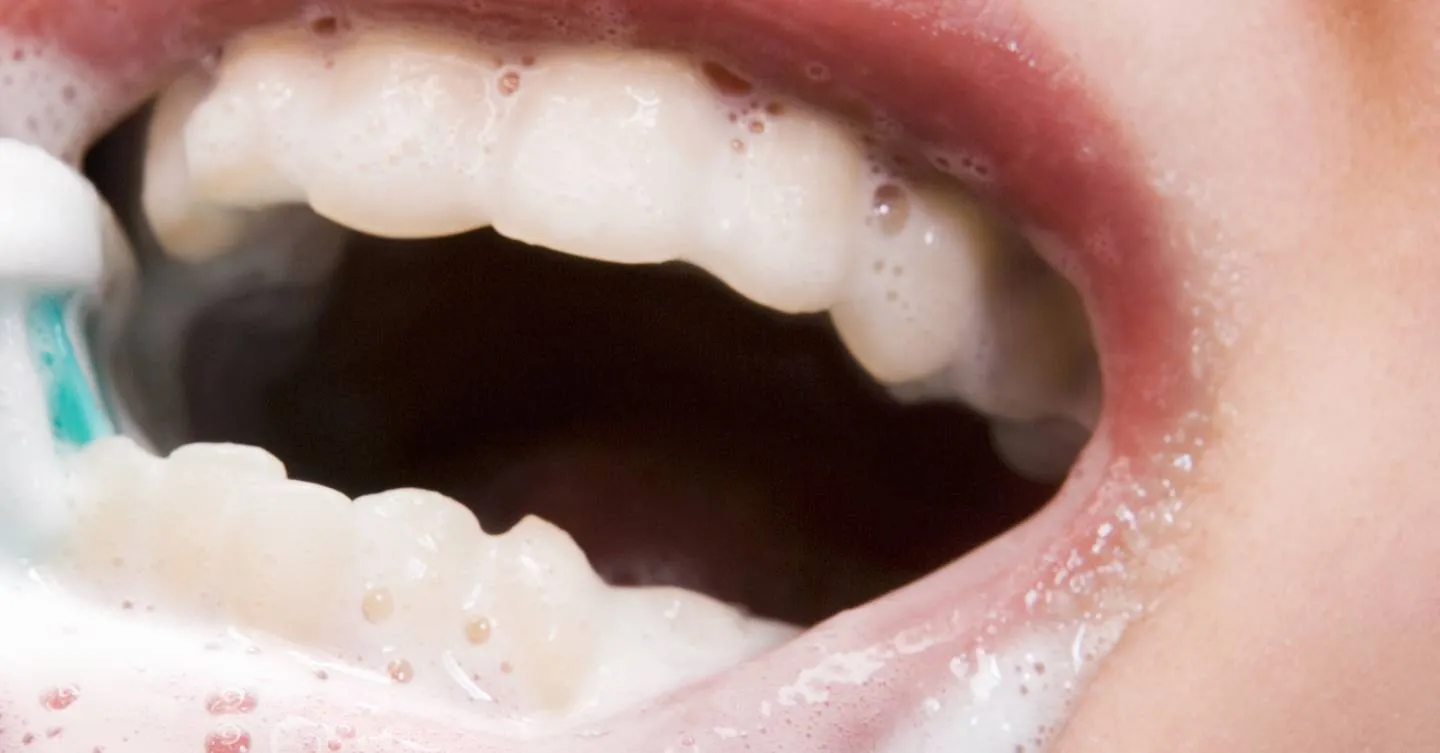 28280 teeth whitening process