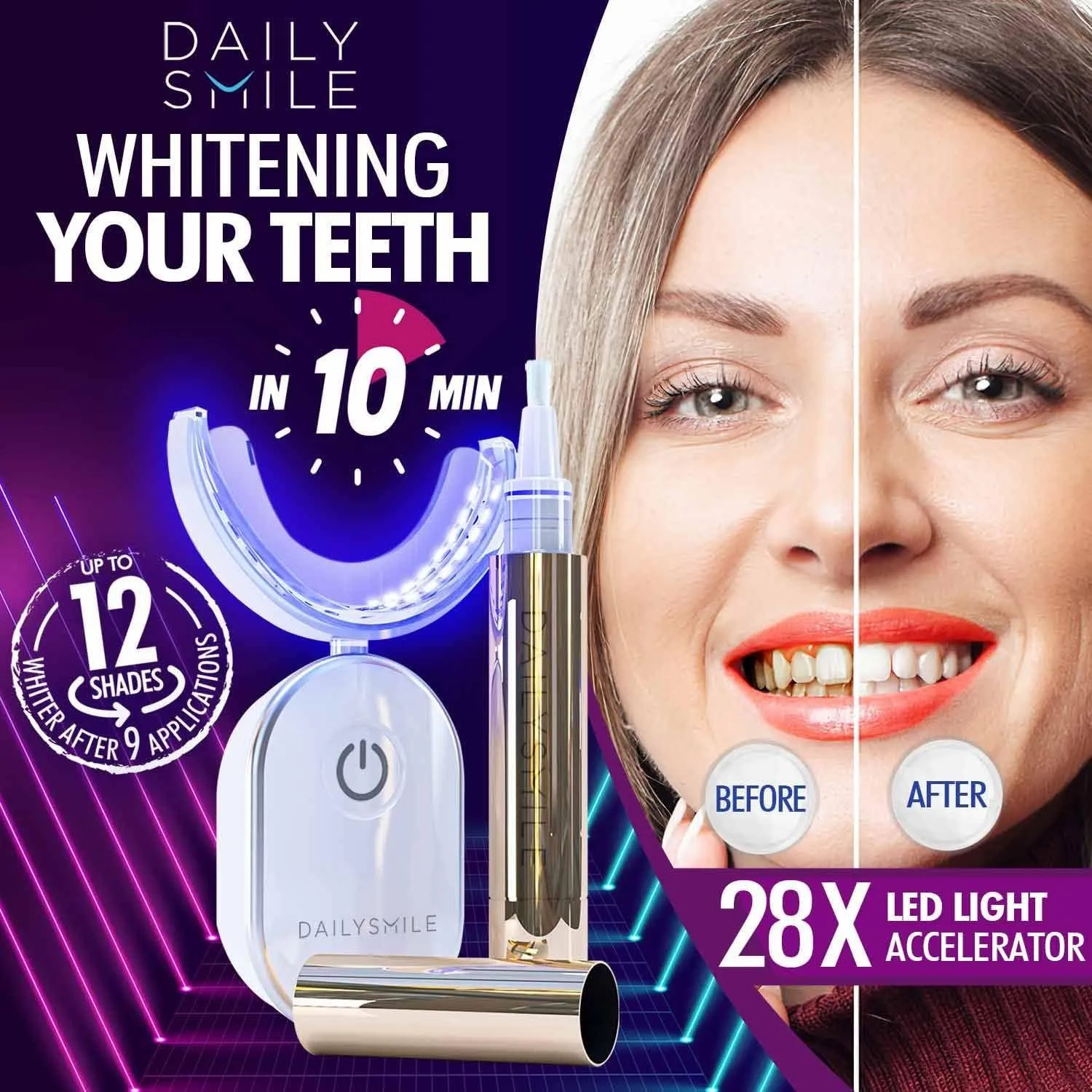 28281 vs1 teeth whitening kit before after