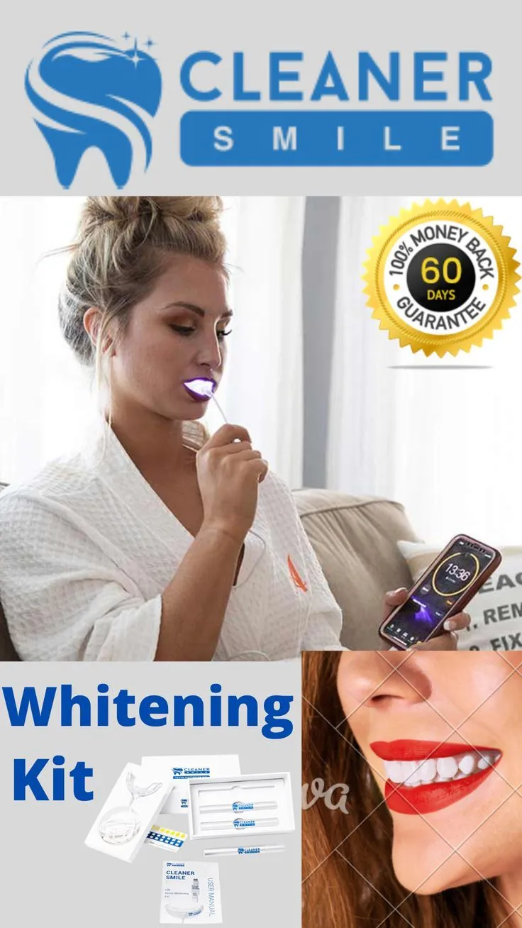 28281 vs1 teeth whitening kit customer reviews